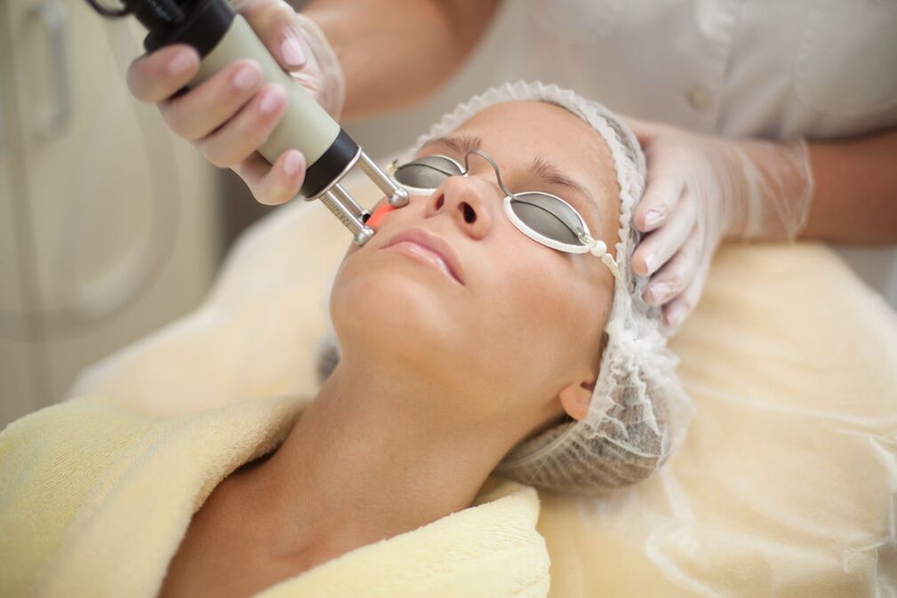 Naha laser noorendamine