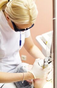 Arst viib läbi fototermolüüsi protseduuri